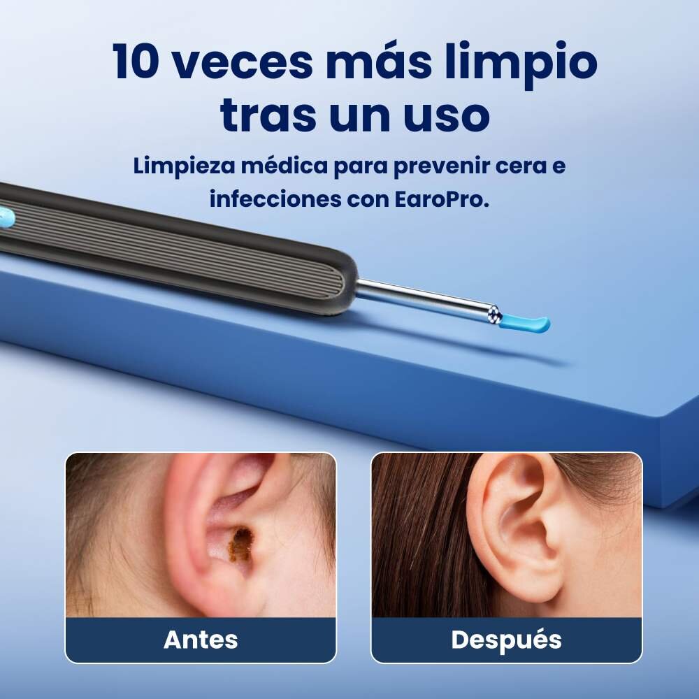 OmniHear image