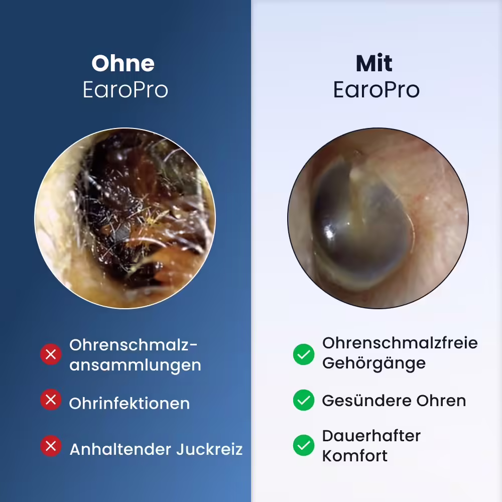 OmniHear image